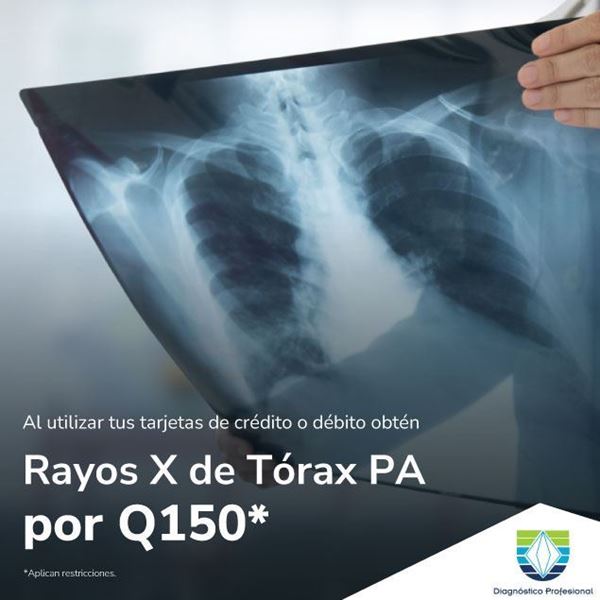 Foto de Rayos X de tórax PA por Q150 en DIAGNOSTICO PROFESIONAL